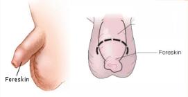 Illustrations of intact or uncircumcised penis showing the foreskin